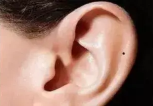耳朵长痣代表什么（耳朵长痣的位置图解）-米圈号